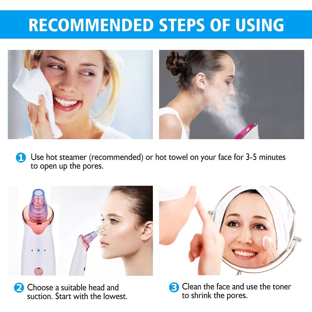 Electric Facial Blackhead Remover | Chill Fun Mall